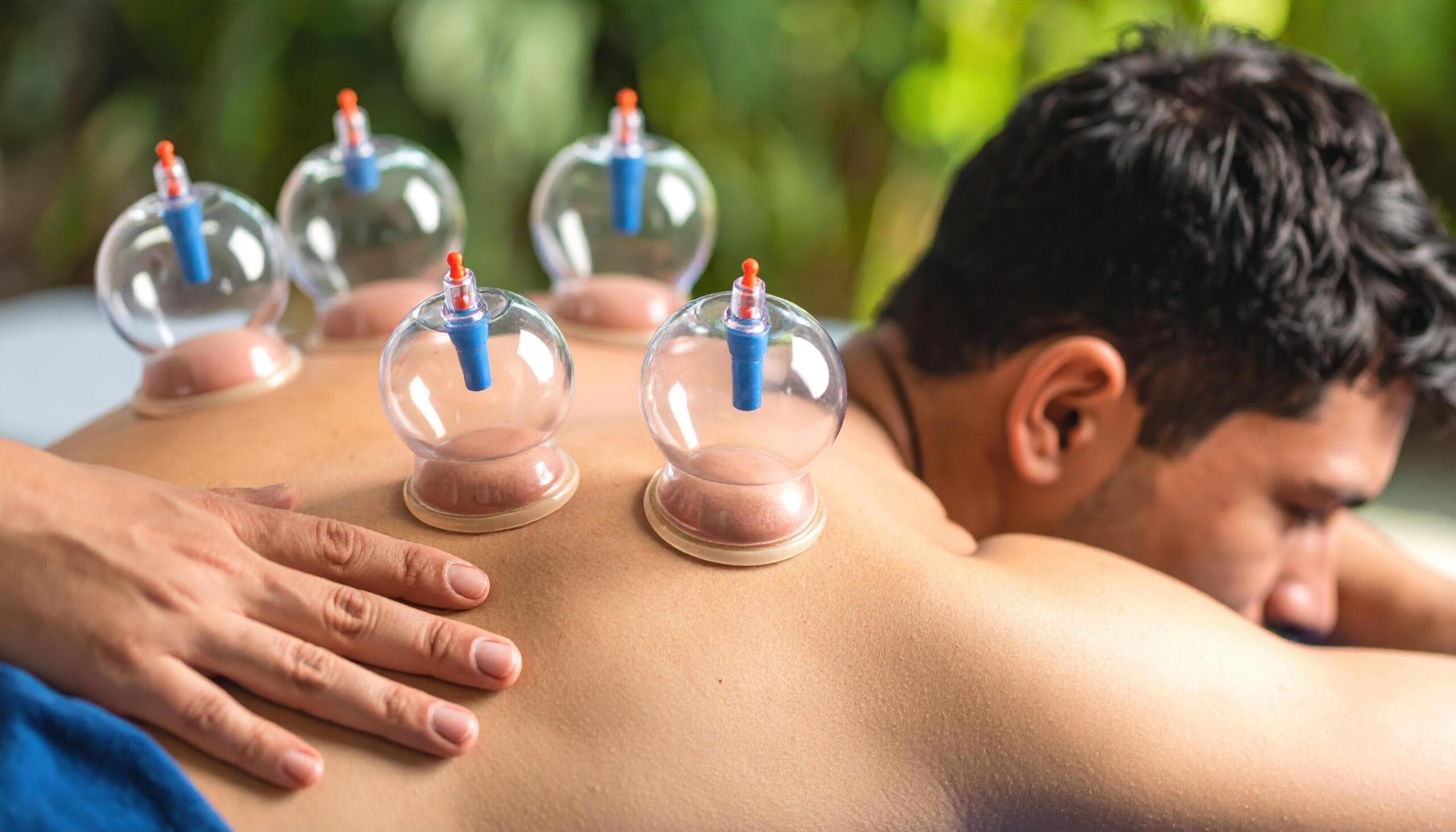 Glendora, CA — Are Cupping Services the Right Choice for Joint Pain?